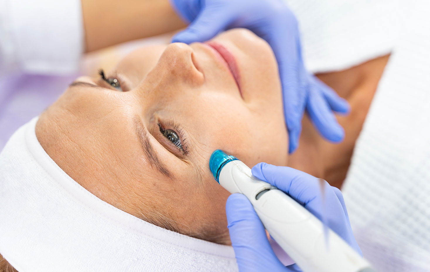 Luxurious Microdermabrasion Treatment | Hello Laser: Reveal Radiant, Youthful Skin.