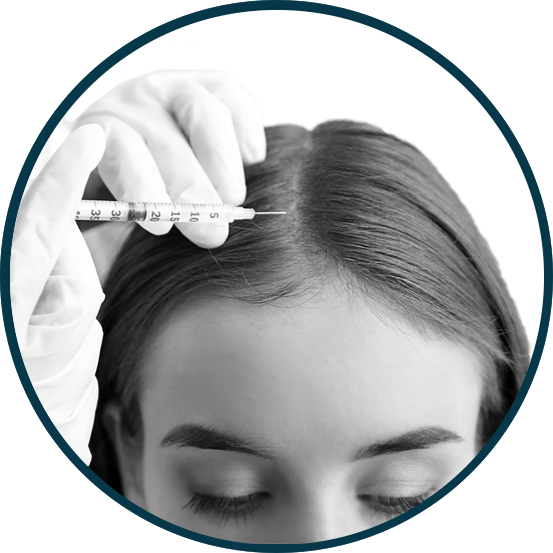 PRF Injections for hair restoration at Hello Laser Spa