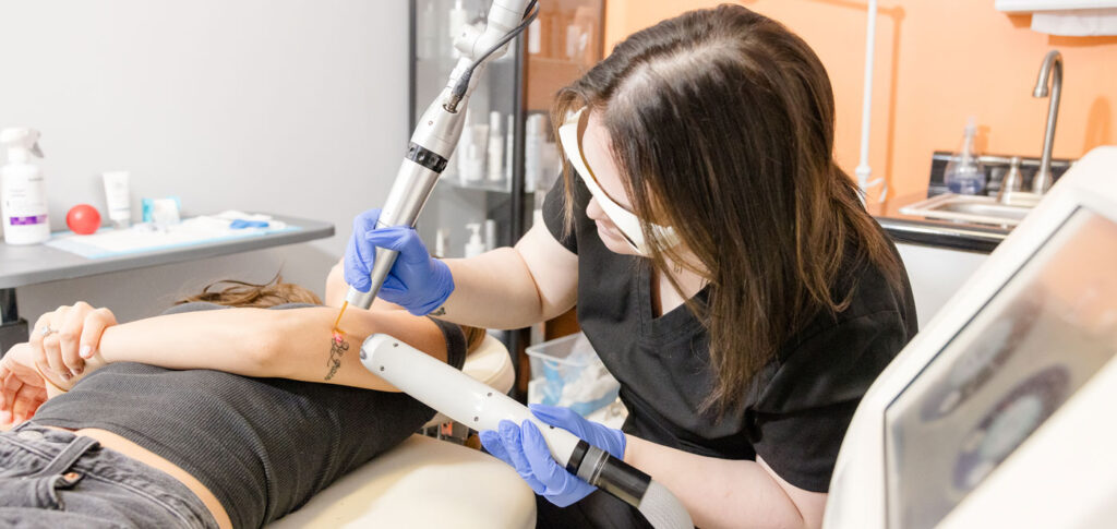 The science behind tattoo removal at Hello Laser